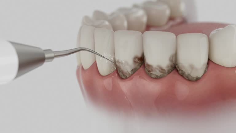 Trusted Dental Implants service in Wyanet, IL - Dentist Open Now